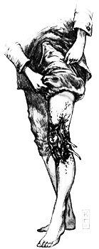 Голиаф Голиаф