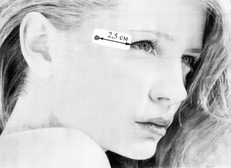 Пиявки. Домашняя гирудотерапия