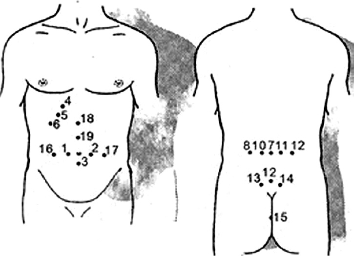 Пиявки. Домашняя гирудотерапия Пиявки. Домашняя гирудотерапия