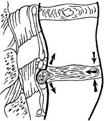 Остеохондроз и плоскостопие у мужчин. Супермен и соломинка. Профилактика, диагностика, лечение Остеохондроз и плоскостопие у мужчин. Супермен и соломинка. Профилактика, диагностика, лечение
