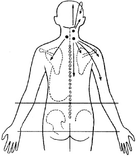 Остеохондроз и плоскостопие у мужчин. Супермен и соломинка. Профилактика, диагностика, лечение Остеохондроз и плоскостопие у мужчин. Супермен и соломинка. Профилактика, диагностика, лечение