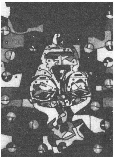 Мигрень Мигрень