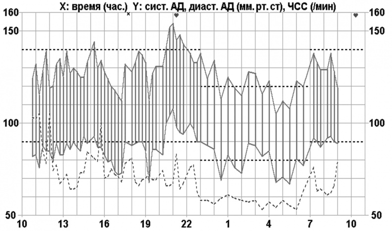 Как прожить без инфаркта и инсульта Как прожить без инфаркта и инсульта