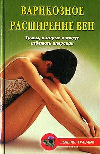 Варикозное расширение вен. Травы, которые помогут избежать операции - Вера Подколзина