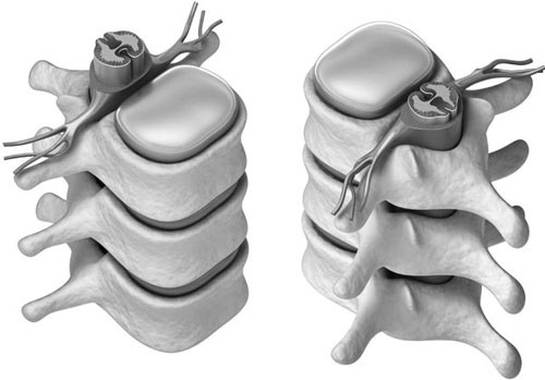 Отложение солей. Диагностика и лечение