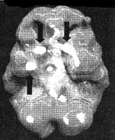 Измените свой мозг - изменится и жизнь! Измените свой мозг - изменится и жизнь!