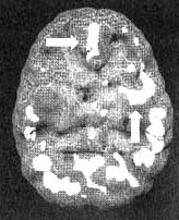 Измените свой мозг - изменится и жизнь! Измените свой мозг - изменится и жизнь!