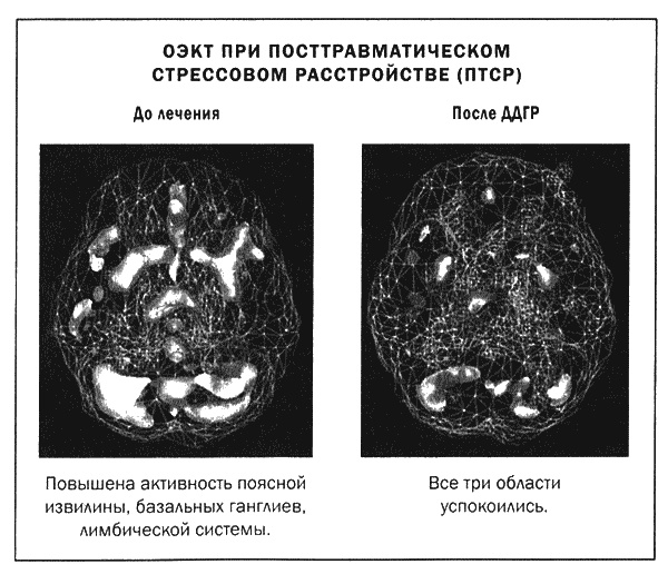 Мозг и душа. Новые открытия о влиянии мозга на характер, чувства, эмоции