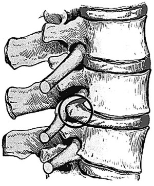 Жизнь без боли в шее Жизнь без боли в шее