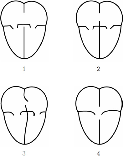 Детское сердечко Детское сердечко