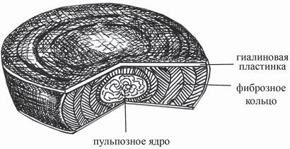 Остеохондроз для профессионального пациента Остеохондроз для профессионального пациента