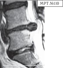 Остеохондроз для профессионального пациента Остеохондроз для профессионального пациента