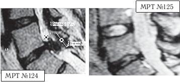 Остеохондроз для профессионального пациента Остеохондроз для профессионального пациента