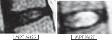 Остеохондроз для профессионального пациента Остеохондроз для профессионального пациента