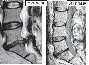 Остеохондроз для профессионального пациента Остеохондроз для профессионального пациента