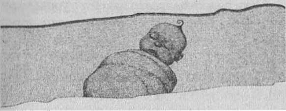 Странности нашего тела. Занимательная анатомия Странности нашего тела. Занимательная анатомия