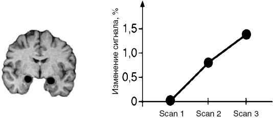 Антимозг. Цифровые технологии и мозг Антимозг. Цифровые технологии и мозг