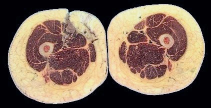Я тоже была толстой Я тоже была толстой