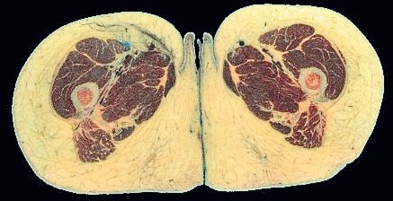 Я тоже была толстой Я тоже была толстой