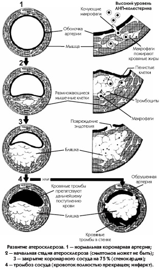 Заболевания сердца и сосудов. Профилактика и лечение Заболевания сердца и сосудов. Профилактика и лечение