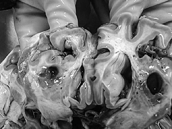 Маломобильный пациент Маломобильный пациент