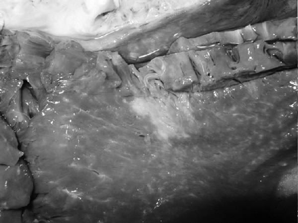 Маломобильный пациент Маломобильный пациент