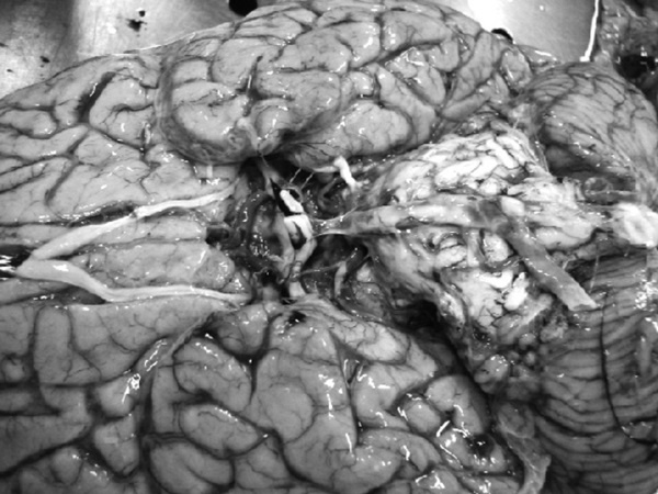 Маломобильный пациент Маломобильный пациент