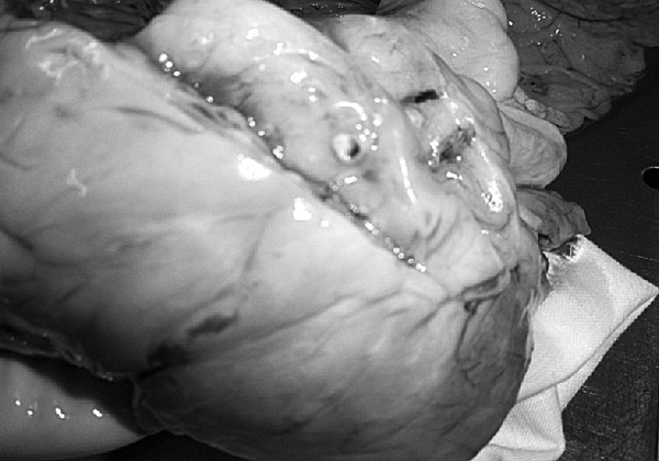 Маломобильный пациент Маломобильный пациент