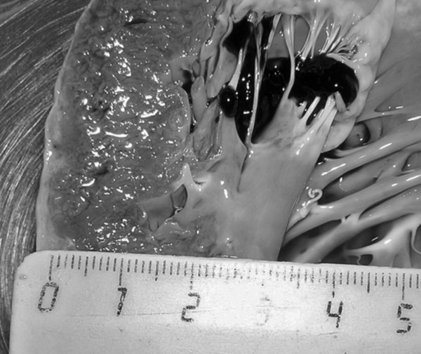 Маломобильный пациент Маломобильный пациент