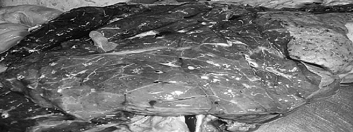 Маломобильный пациент Маломобильный пациент