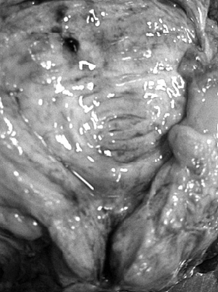 Маломобильный пациент Маломобильный пациент