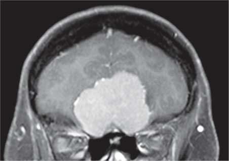 Удивительные истории о мозге, или рекорды памяти коноплянки