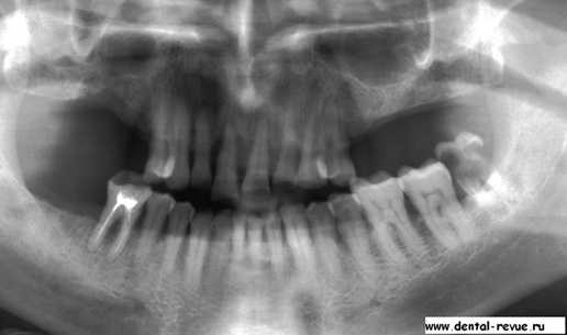 Судьба педераста или непридуманные истории из жизни… Судьба педераста или непридуманные истории из жизни…