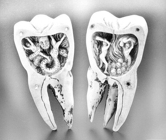 Из истории зубоврачевания, или Кто лечит зубы монархам