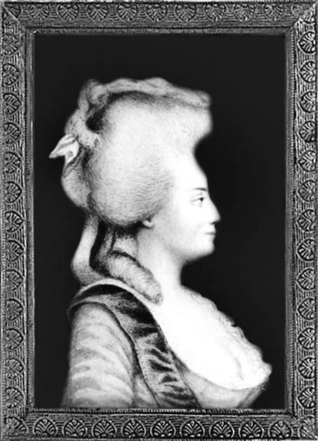 Из истории зубоврачевания, или Кто лечит зубы монархам