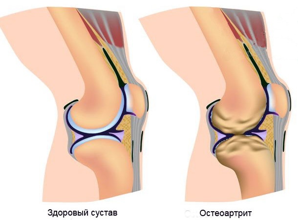 Теломераза. Как сохранить молодость, укрепить здоровье и увеличить продолжительность жизни