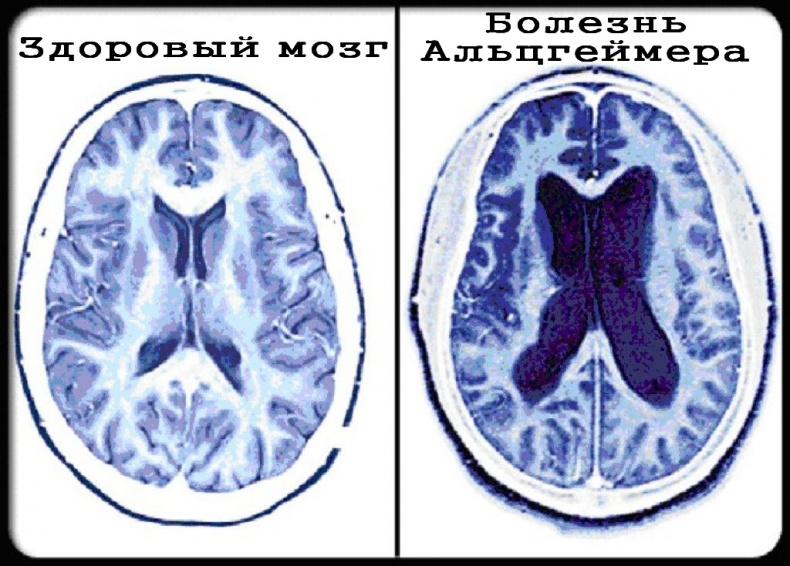 Теломераза. Как сохранить молодость, укрепить здоровье и увеличить продолжительность жизни