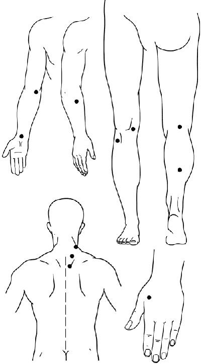 Работа с триггерными точками: расслабляем мышцы, избавляемся от боли
