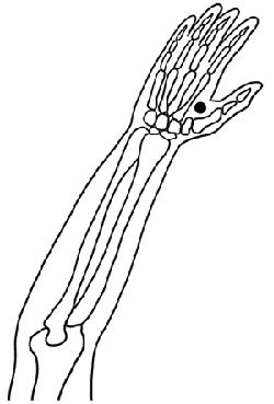 Работа с триггерными точками: расслабляем мышцы, избавляемся от боли