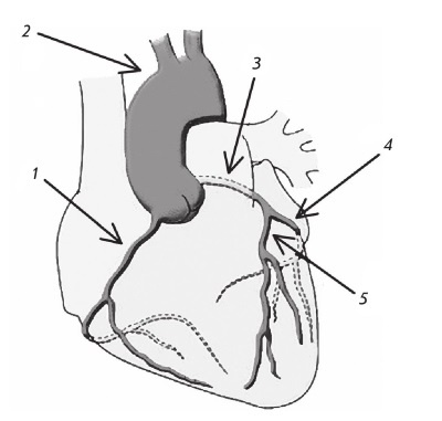 Стенокардия Стенокардия