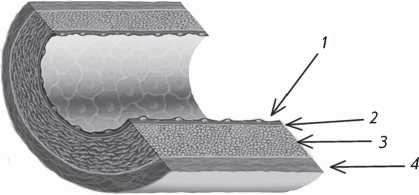 Стенокардия Стенокардия