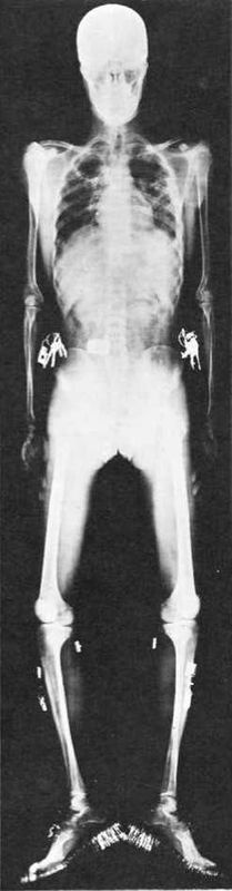 Восхождение человечества