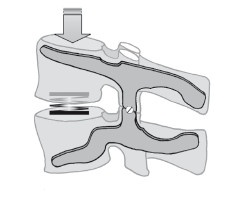 Диагностика и лечение позвоночника. Уникальная система доктора А. М. Уриа Диагностика и лечение позвоночника. Уникальная система доктора А. М. Уриа