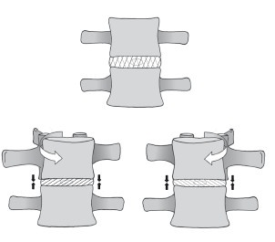 Диагностика и лечение позвоночника. Уникальная система доктора А. М. Уриа Диагностика и лечение позвоночника. Уникальная система доктора А. М. Уриа