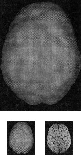 Мозг. От хорошего к превосходному