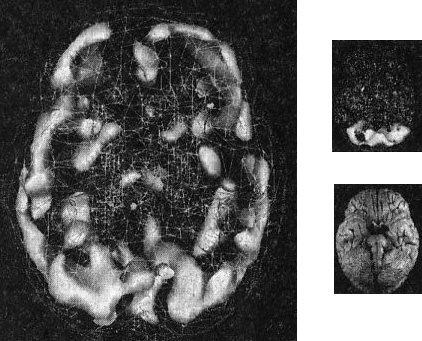 Мозг. От хорошего к превосходному