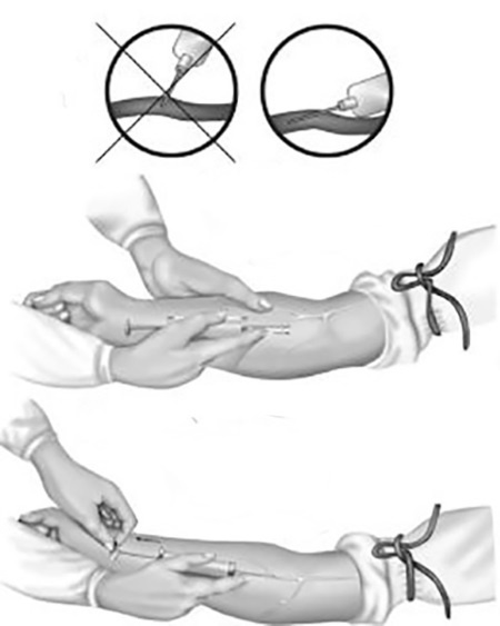 Уколы, капельницы, перевязки и другие медицинские процедуры и манипуляции Уколы, капельницы, перевязки и другие медицинские процедуры и манипуляции
