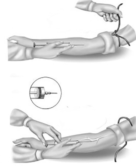 Уколы, капельницы, перевязки и другие медицинские процедуры и манипуляции Уколы, капельницы, перевязки и другие медицинские процедуры и манипуляции