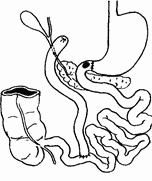 Этюды желудочной хирургии