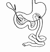 Этюды желудочной хирургии